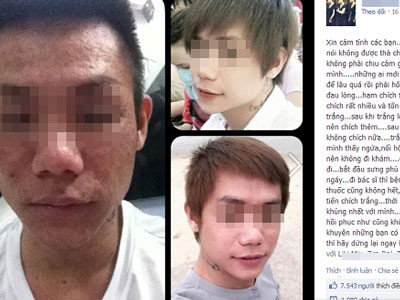Một teen là nạn nhân của làm đẹp cảnh báo các teen trên facebook của mình