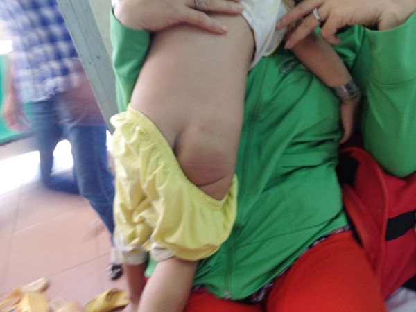 Bảo vệ khẩn cấp bé ba tuổi nghi bị bạo hành