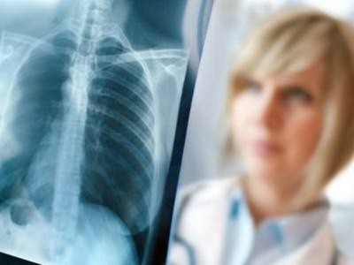Viêm phổi – chớ nên coi thường