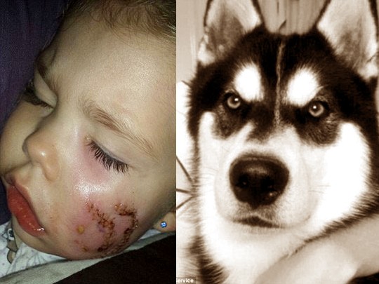 Bé gái 3 tuổi bị chó cắn nát 1 bên mặt