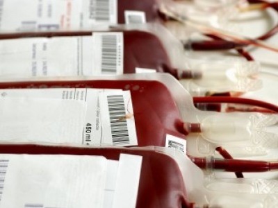Thiếu máu và cách phòng ngừa