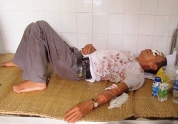 Hơn 30 người Việt thương vong vụ lật xe ở Lào