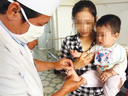 Bác sĩ bệnh viện đa khoa Sa Đéc đang thăm khám cho trẻ bị mắc bệnh tay chân miệng