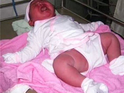 Sản phụ sinh em bé nặng 6kg ở Bình Thuận