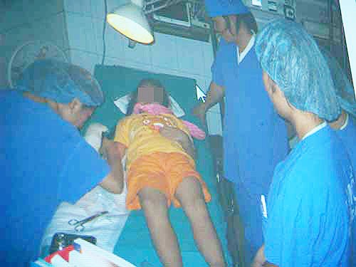 Cháu Trịnh Ngọc Bích đang được các bác sĩ Bệnh viện Việt Đức chăm sóc