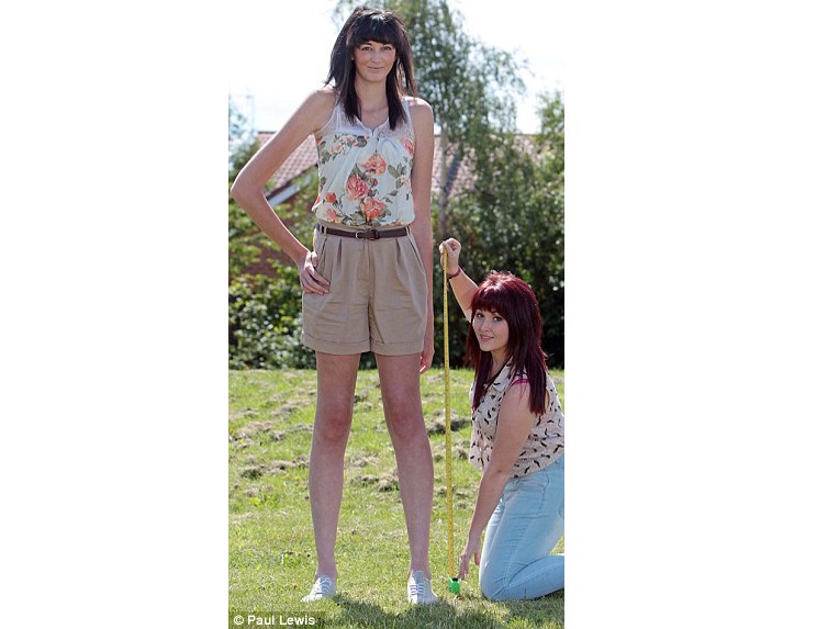 Thiếu nữ 18 tuổi cao hơn 2 m