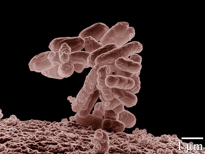 E.coli gây dịch bệnh tại châu Âu thuộc chủng mới