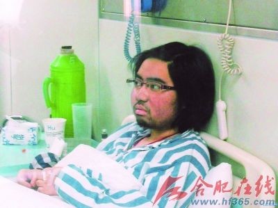 Mei Wang mọc đầy râu quai nón tại bệnh viện ở Thường Châu