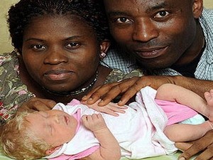 Bố mẹ da đen sinh con da trắng thuần chủng