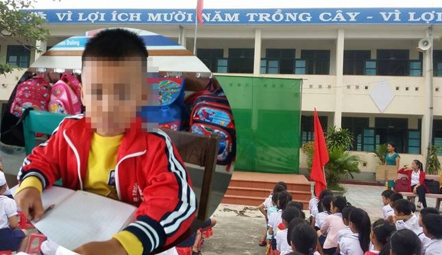 Cô giáo Quảng Bình tát học sinh chấn động não bị xử lý thế nào?