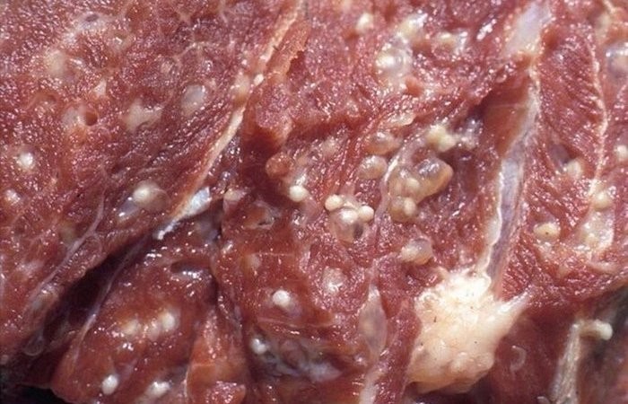 Ăn phải thịt lợn nhiễm sán có thể nguy hiểm thế nào?