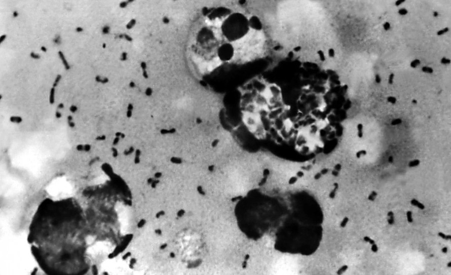 Vi khuẩn gây bệnh dịch hạch nhìn dưới kính hiển vi. (Ảnh: Shutterstock)