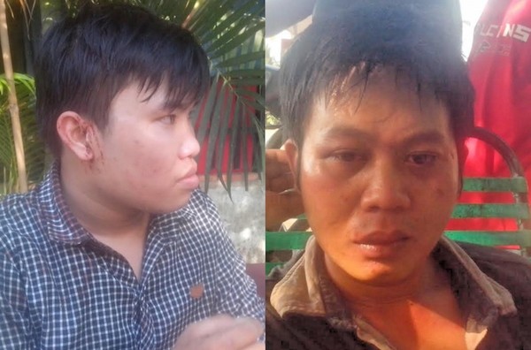 Hai phóng viên Vĩnh Phú (phải) và Linh Hoàng (trái) đầy thương tích sau khi bị nhóm côn đồ hành hung. Ảnh Báo Giao thông.