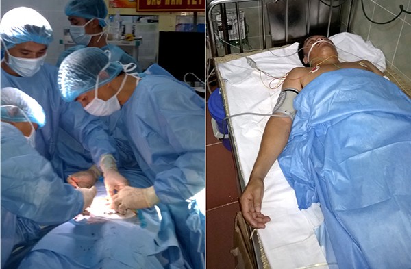 Anh Nguyễn Văn Phó đang được mổ ruột thừa và sau khi được mổ ruột thừa.