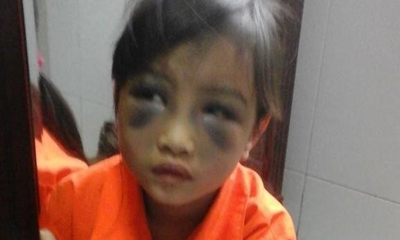 Hình ảnh cô học trò lớp 1 ở Lao Cai bị giáo viên đánh vì viết sai chính tả gây nhức nhối về "đạo làm thầy".
