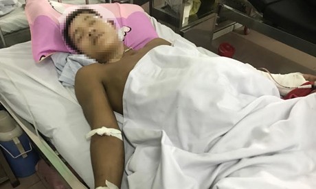 Hiện, nạn nhân Vương đang được điều trị tại BVĐK 115 Nghệ An trong tình trạng hôn mê sâu.