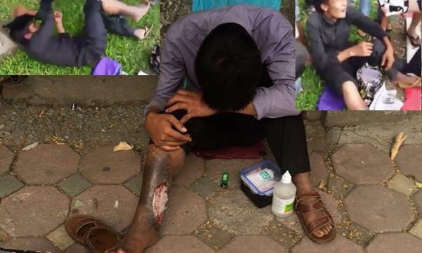 Xôn xao clip đánh te tua kẻ giả vờ hoại tử chân xin tiền ở Hà Nội 