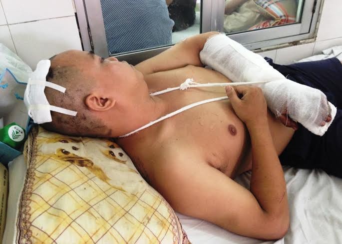 Nạn nhân Phạm Văn Mạnh bị chém vỡ xương sọ, đứt gân tay đang điều trị tại bệnh viện