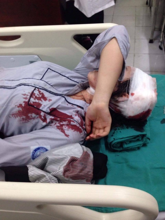 Nữ sinh K.C cấp cứu tại bệnh viện sau khi bị đánh (ảnh mạng xã hội) 