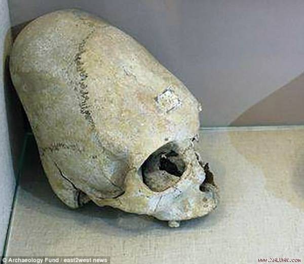 Các chiến binh Sarmatia cổ đại đều có phần hộp sọ dài khác thường. 