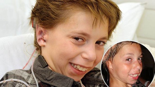 Ghép tai làm từ sụn người cho cậu bé 9 tuổi