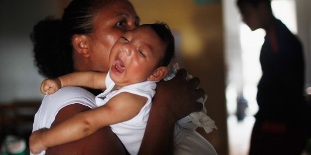 Một em bé bị bệnh đầu nhỏ do virus Zika. Ảnh: Mario Tama.