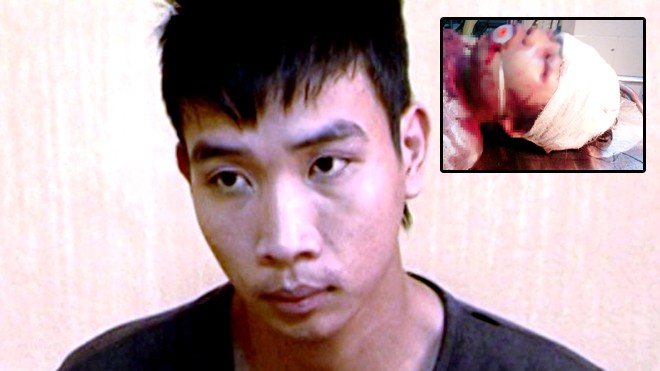 Nghi phạm đánh dã man bé 14 tuổi ở Thanh Hóa và Bé gái Đỗ Thị Oanh bị đánh vô cùng dã man với nhiều vết thương trên đầu và mặt (Ảnh gia đình cung cấp)