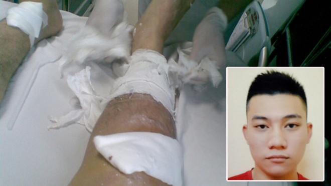 Các nạn nhân bị thương tích nặng, phải cấp cứu ở bệnh viện và Nguyễn Khánh Long - một trong ba tên côn đồ tham gia đâm chém (ảnh nhỏ)