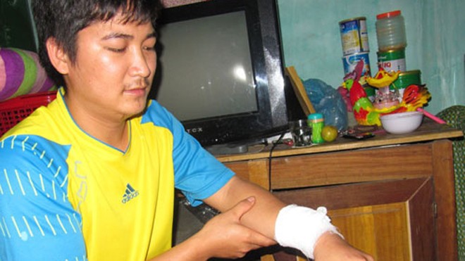 Anh Chung bị một viên đạn trúng vào cổ tay - Ảnh: Khánh Hoan