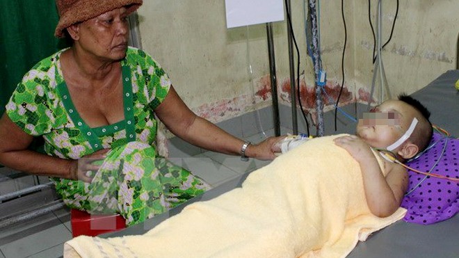 Bà Thạch Thị Sương, bà ngoại bé Khương Minh Khôi đang chăm sóc bé tại Bệnh viện Đa khoa Bạc Liêu. (Ảnh: Thanh Liêm/TTXVN) 