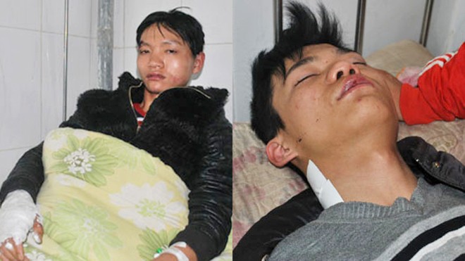 Nạn nhân Quách Văn Dương bị gãy tay phải, chấn thương khắp cơ thể (ảnh trái) còn Bùi Văn Thảo bị đánh trọng thương hiện được cấp cứu tại Bệnh viện Thạch Thành