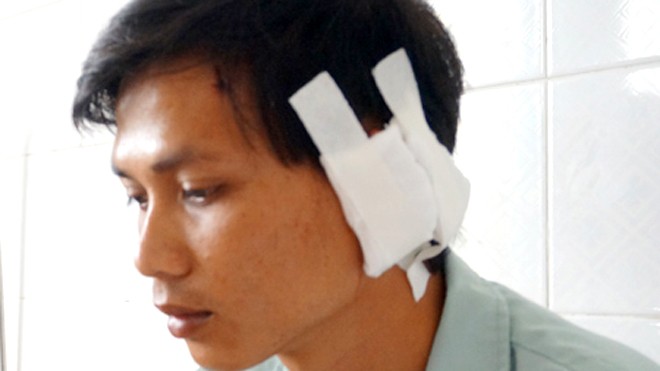Anh Tuấn đang điều trị tại Bệnh viện Đa khoa Long An. Ảnh: Dân Việt