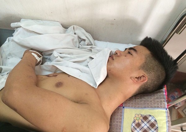 Nguyễn Ngọc Tuấn đang điều trị tại bệnh viện