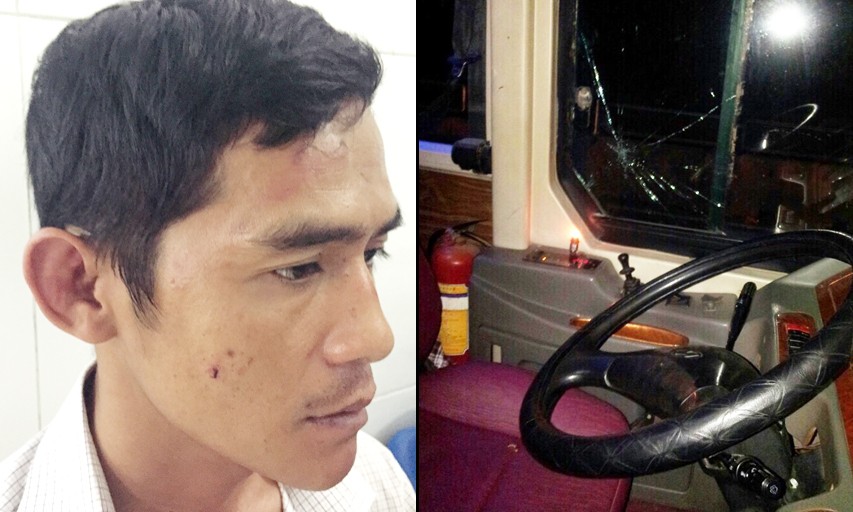 Lái xe Trần Hùng Cường đang được điều trị tại bệnh viện và nơi nạn nhân ngất gục vì bị đánh hội đồng