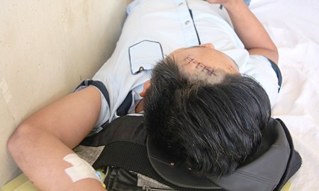 Anh Minh đang điều trị tại Bệnh viện Đa khoa tỉnh Khánh Hòa