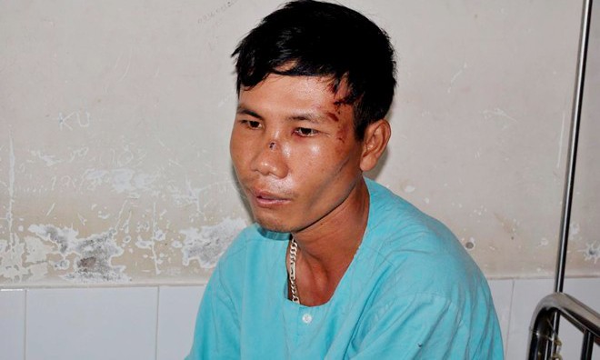 Nạn nhân Phan Văn Quỳnh đang được điều trị tại bệnh viện. Ảnh: Ngọc An