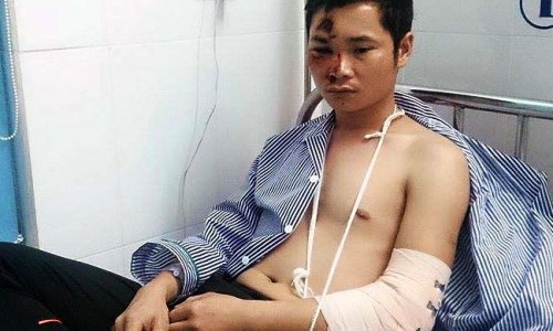Anh Đặng Thành Chung, Giám đốc Công ty TNHH Đức Nguyên đang điều trị tại bệnh viện Việt- Tiệp Hải Phòng
