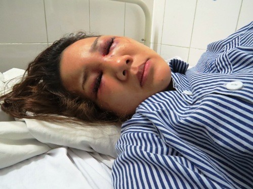 Chị Nguyễn Phương Thảo tại bệnh viện