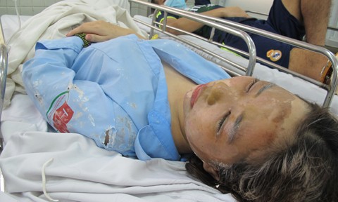 Nữ sinh Hương lúc mới nhập viện