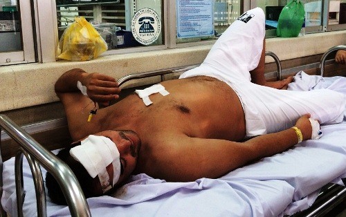 Anh Rachid bị đâm trúng trán và ngực đang điều trị tại Chợ Rẫy. Ảnh: Hải Hiếu