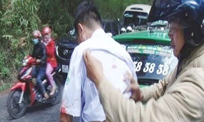 Tài xế taxi bị đâm trọng thương - Ảnh: Kim Đồng 