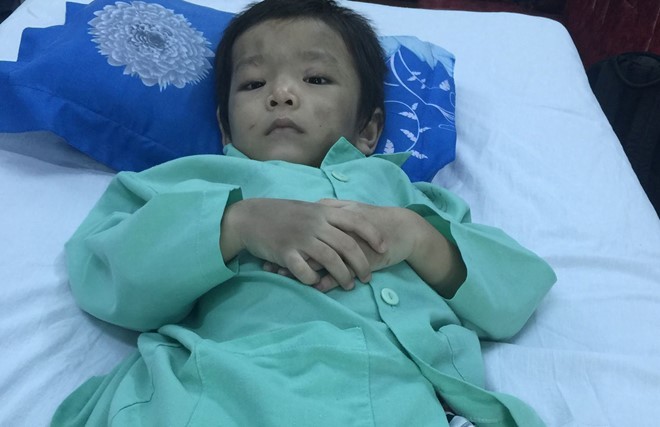 Bé trai bị cha mẹ bạo hành đa chấn thương sẽ được Bệnh viện Chấn thương chỉnh hình miễn phí điều trị. Ảnh: Khánh Trung