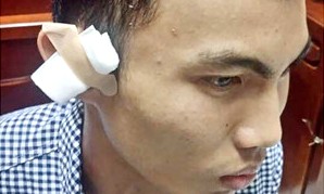 Anh Thắng tố cáo bị ông Nguyễn Lê Minh bắn bị thương ở tai