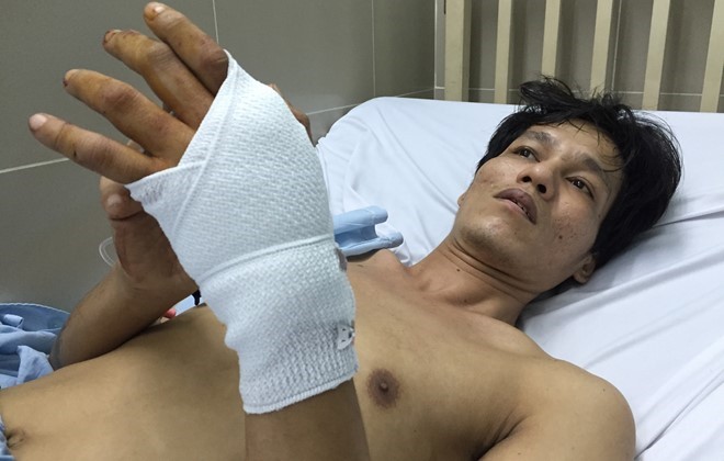 Anh Lâm bị bắn xuyên tay được điều trị trong bệnh viện. Ảnh: Zing