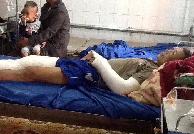 Anh Hào bị đánh gãy 2 tay, chân đang nằm điều trị tại bệnh viện