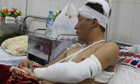 Các bác sĩ cho biết anh Phạm Đình Trung được xác định đứt cơ cánh tay trái, xương sọ bị mẻ.