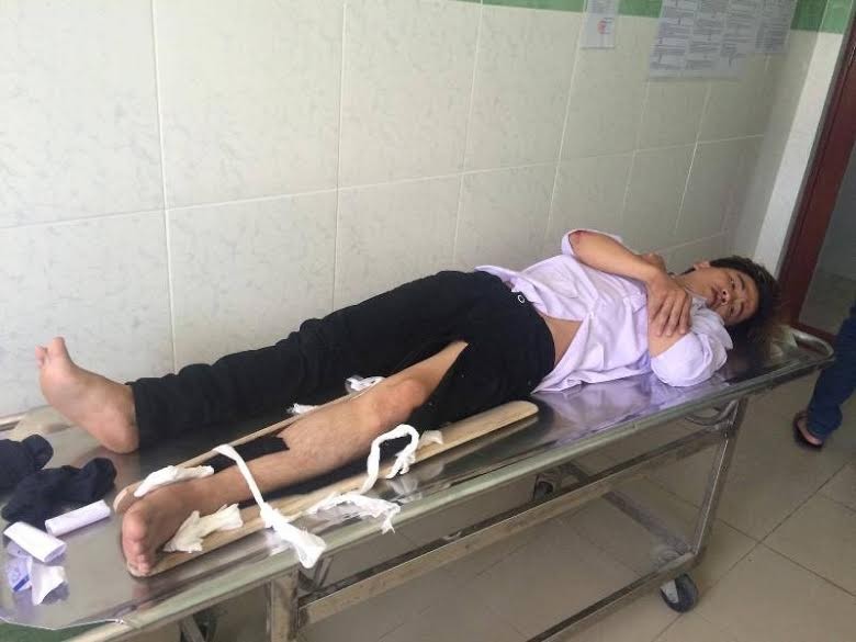 Một trong hai thanh niên lao xe vào CSGT đang được điều trị tại bệnh viện. Ảnh C.Thạch