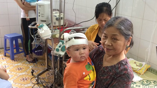 Bệnh nhân phát ban dạng sởi nặng đang điều trị tại BV Saint Paul (Hà Nội). Ảnh T.Hà 