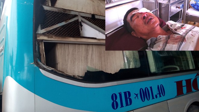 Xe khách ở Gia Lai bị ném đá vỡ kính (ảnh lớn). Ông Trương Triệu Lương đang điều trị mắt (ảnh nhỏ)