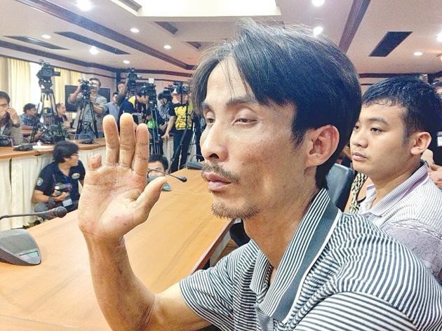 Anh Tai Hua Hai bị băng bắt cóc cắt ngón tay để tống tiền. Ảnh: The Nation 